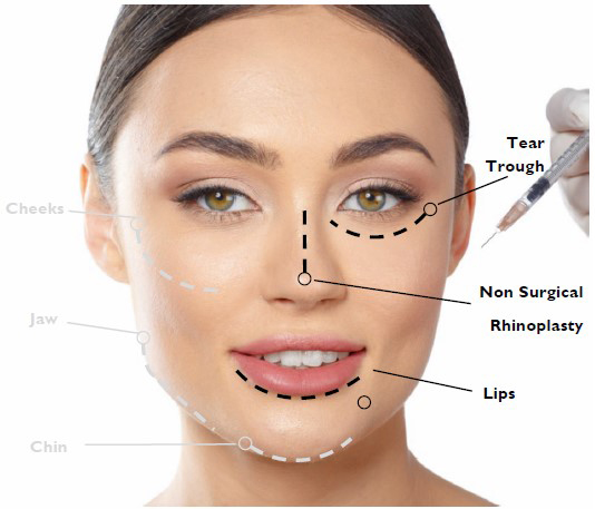 Dermal Fillers