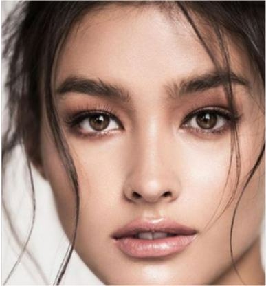 6 - Dermal Fillers